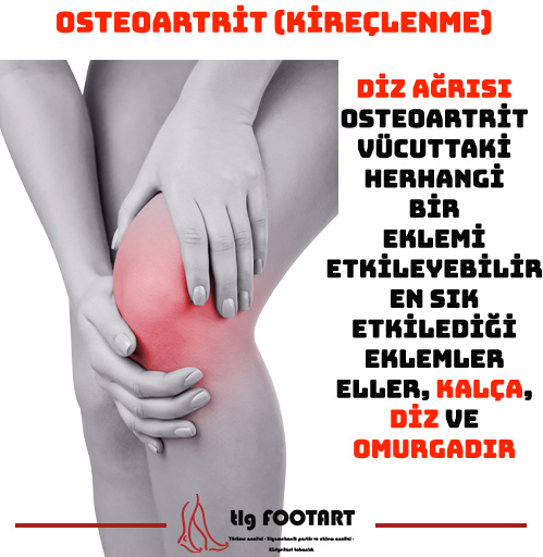 OSTEOARTRİT (KİREÇLENME)?