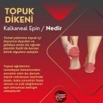 TOPUK DİKENİ